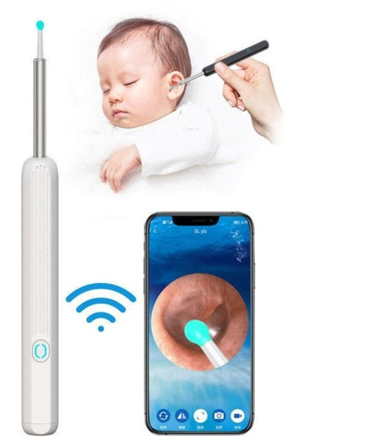 Smart Visual Earwax Removal Kit – HD Camera Ear Cleaner with LED & WiFi Connection