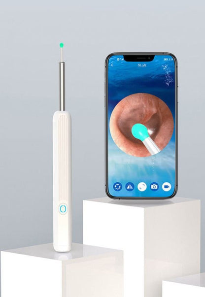 Smart Visual Earwax Removal Kit – HD Camera Ear Cleaner with LED & WiFi Connection