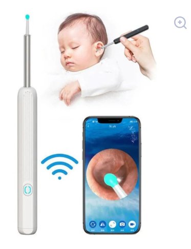 Smart Visual Earwax Removal Kit – HD Camera Ear Cleaner with LED & WiFi Connection