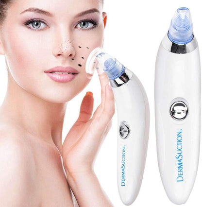 Blackhead Remover Pore Vacuum – USB Rechargeable Facial Deep Cleaning Device