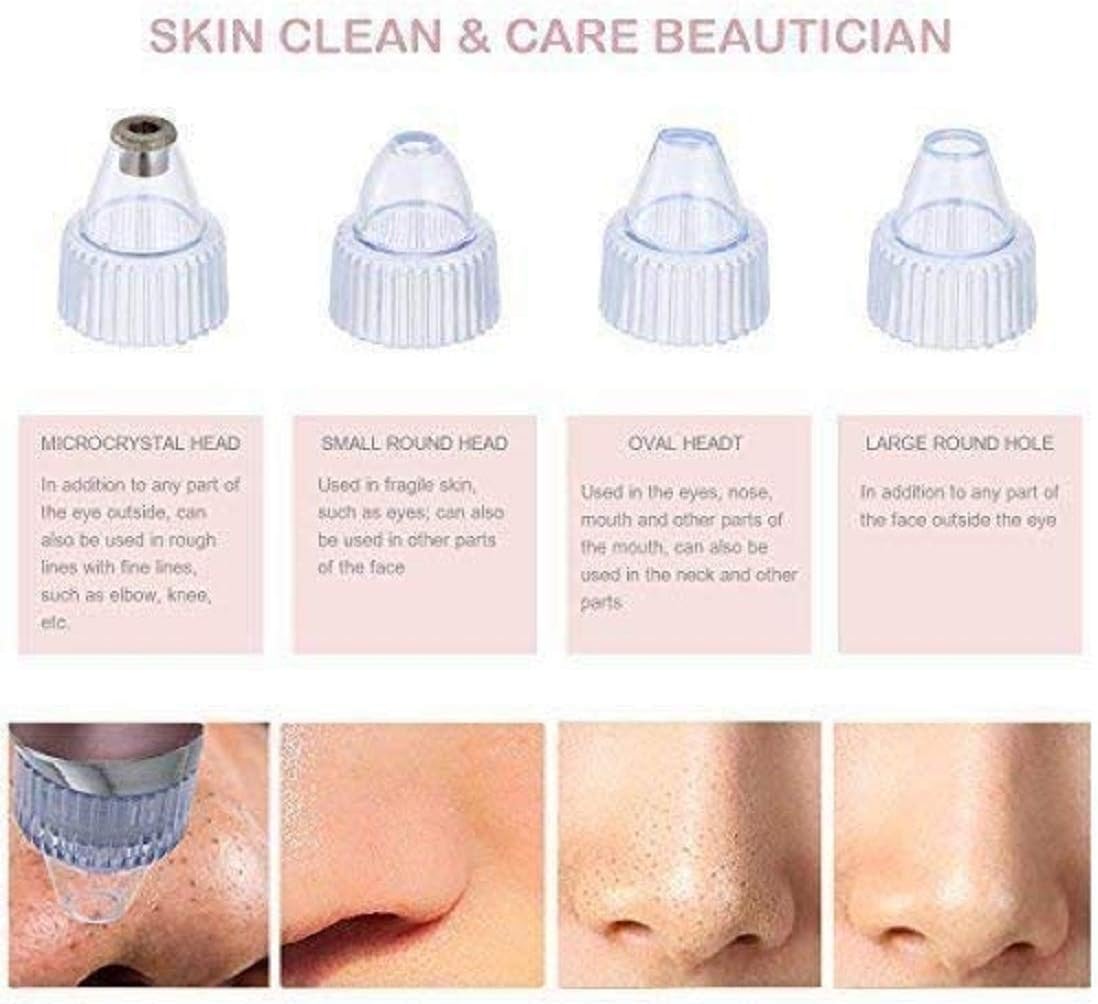 Blackhead Remover Pore Vacuum – USB Rechargeable Facial Deep Cleaning Device