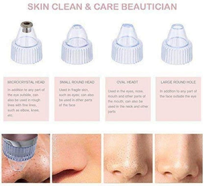 Blackhead Remover Pore Vacuum – USB Rechargeable Facial Deep Cleaning Device