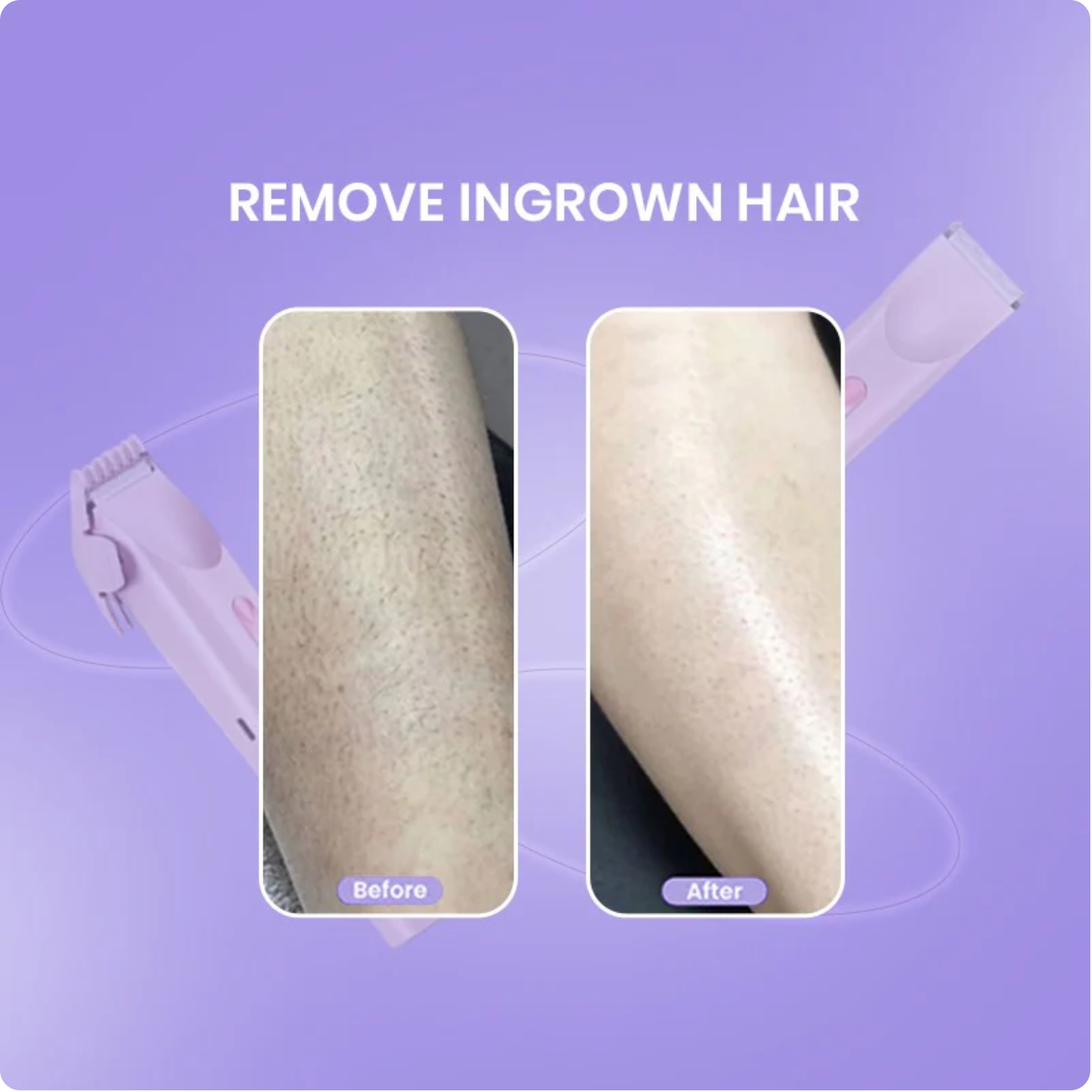 Double Head Electric Shaver for Women – Waterproof Wet & Dry Portable Hair Removal Trimmer