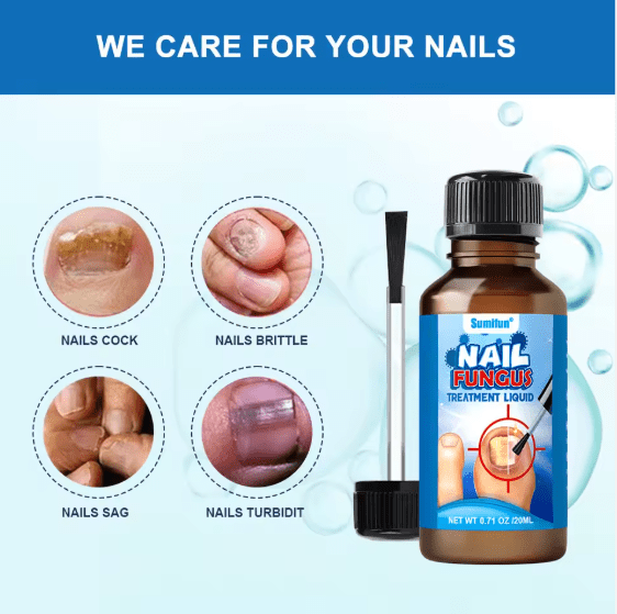 Sumifun Nail Care Treatment Liquid – Repair & Restore Damaged Nails (20ml)