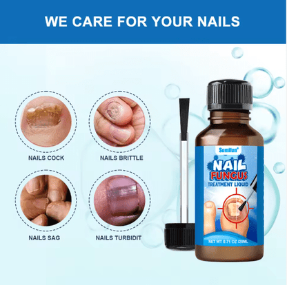 Sumifun Nail Care Treatment Liquid – Repair & Restore Damaged Nails (20ml)